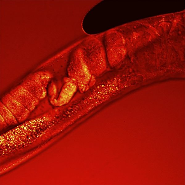 CARS Z-stack of C.Elegans worm, visualizing lipids 19